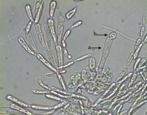 Kumanoa ambigua trichogyne (a) with attached spermatium (b), Costa Rican specimen.
